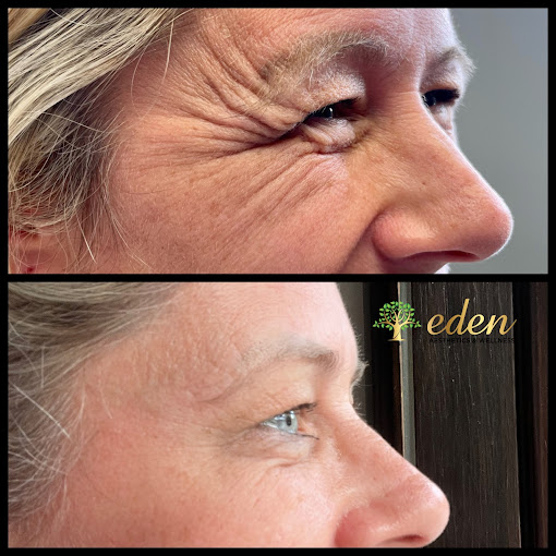 Eden Aesthetics & Wellness business image in Kansas City, MO